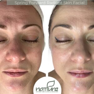 Spring Forward Radiant Skin Facial Protocol Bundle