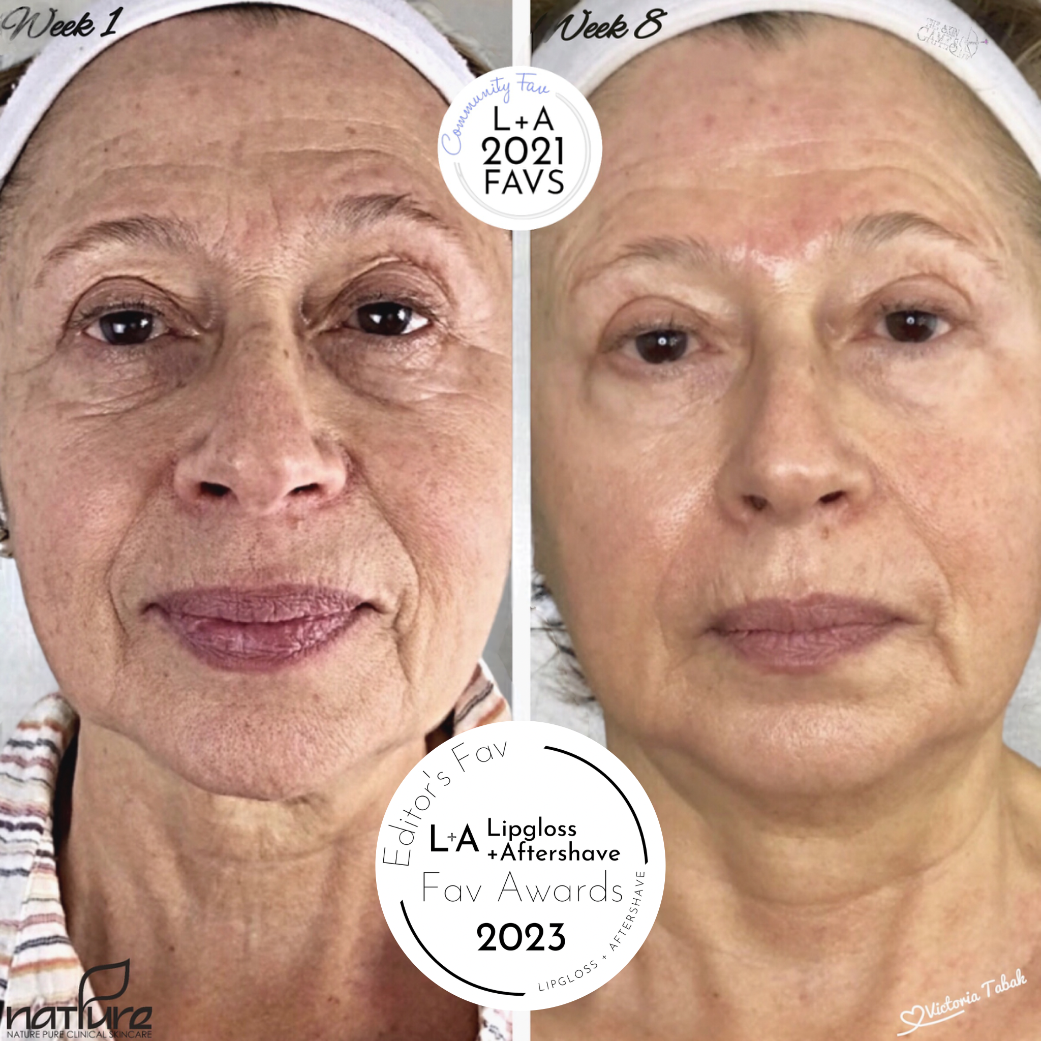 Dissolve Wrinkles & Reverse Menopausal Skin Change Modified Bundle without Microneedling